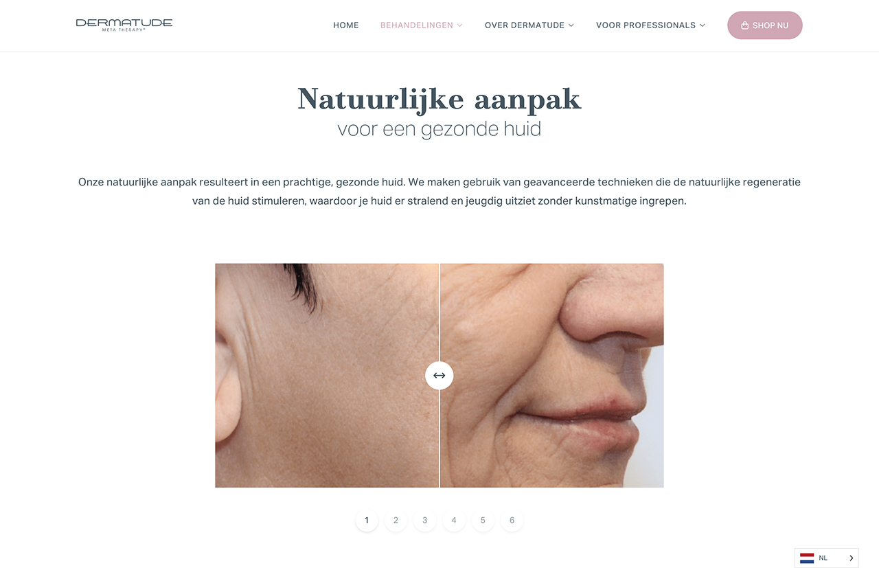 Close-up van het gezicht van een vrouw, waarbij de opmerkelijke verbetering van de huidtextuur met Dermatude wordt benadrukt in een voor- en navergelijking.